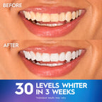 Crest 3DWhitestrips at Home Teeth Whitening Kit, Professional Express + Whitening Light, 1 Light + 19 Treatments, 38 Strips